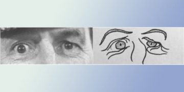 Study: Autistic People Recognize Emotions Better Than Neurotypical in Cartoons